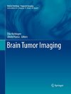 Brain Tumor Imaging