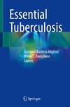 Essential Tuberculosis