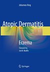 Atopic Dermatitis