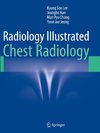 Radiology Illustrated: Chest Radiology