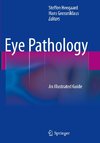 Eye Pathology