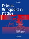 Pediatric Orthopedics in Practice