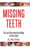 Missing Teeth