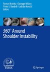 360° Around Shoulder Instability