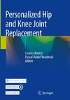 Personalized Hip and Knee Joint Replacement