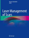 Laser Management of Scars