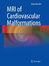 MRI of Cardiovascular Malformations