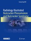 Radiology Illustrated: Nutcracker Phenomenon and Nutcracker Syndrome