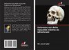 Osteonecrosi delle mascelle indotta da bifosfonati