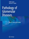 Pathology of Glomerular Diseases