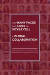 The Many Faces and Lives of Sickle Cell - A Global Collaboration