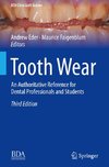 Tooth Wear