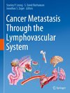 Cancer Metastasis Through the Lymphovascular System