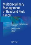 Multidisciplinary Management of Head and Neck Cancer