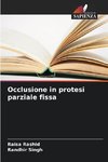 Occlusione in protesi parziale fissa