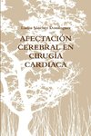 AFECTACIÓN CEREBRAL EN CIRUGÍA CARDIACA