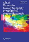 Atlas of Non Invasive Coronary Angiography by Multidetector Computed Tomography