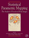 Statistical Parametric Mapping