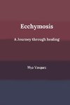 Ecchymosis