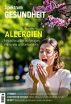 Spektrum Gesundheit - Allergien