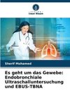 Es geht um das Gewebe: Endobronchiale Ultraschalluntersuchung und EBUS-TBNA