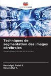 Techniques de segmentation des images cérébrales