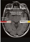 ASS Autismus-Spektrums-Segnung - Asperger-Syndrom, Sucht, Alkoholismus, Spiritualität, Buddhismus