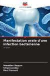 Manifestation orale d'une infection bactérienne