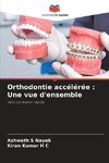 Orthodontie accélérée : Une vue d'ensemble