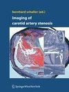 Imaging of Carotid Artery Stenosis