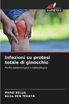 Infezioni su protesi totale di ginocchio