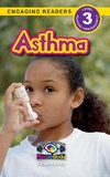 Asthma