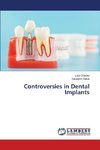 Controversies in Dental Implants