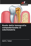 Ruolo della tomografia computerizzata in odontoiatria