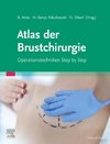 Onkoplastische und rekonstruktive Brustchirurgie