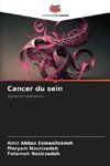 Cancer du sein