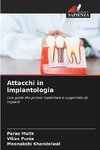 Attacchi in implantologia