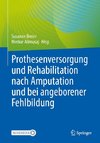 Prothesenversorgung und Rehabilitation nach Amputation und angeborener Fehlbildung