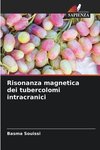 Risonanza magnetica dei tubercolomi intracranici