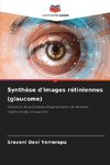 Synthèse d'images rétiniennes (glaucome)