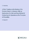 A Short Treatise on the Section of the Prostate Gland in Lithotomy; With an Explanation of a Safe and Easy Method of Conducting the Operation on the Principles of Cheselden