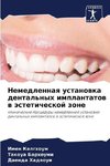 Nemedlennaq ustanowka dental'nyh implantatow w ästeticheskoj zone