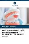 WIEDERHERSTELLUNG ENDODONTISCH BEHANDELTER ZÄHNE