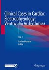 Clinical Cases in Cardiac Electrophysiology: Ventricular Arrhythmias