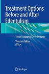 Treatment Options Before and After Edentulism