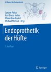 Endoprothetik der Hüfte