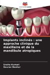 Implants inclinés : une approche clinique du maxillaire et de la mandibule atropiques