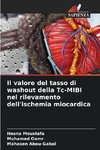 Il valore del tasso di washout della Tc-MIBI nel rilevamento dell'ischemia miocardica