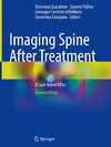 Imaging Spine After Treatment