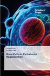 Stem Cells in Periodontal Regeneration